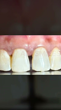 AM Smiles Dental Clinic - Advanced Implants and Aesthetic Dentistry Centre | Taramani-Velachery, Chennai