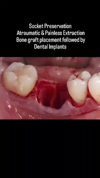 AM Smiles Dental Clinic - Advanced Implants and Aesthetic Dentistry Centre | Taramani-Velachery, Chennai