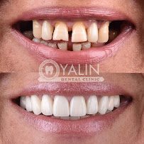 YALIN DENTAL CLINIC / Yalın Ağız ve Diş Sağlığı Polikliniği