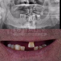 YALIN DENTAL CLINIC / Yalın Ağız ve Diş Sağlığı Polikliniği