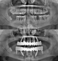 YALIN DENTAL CLINIC / Yalın Ağız ve Diş Sağlığı Polikliniği