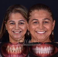 YALIN DENTAL CLINIC / Yalın Ağız ve Diş Sağlığı Polikliniği