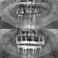 YALIN DENTAL CLINIC / Yalın Ağız ve Diş Sağlığı Polikliniği