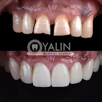 YALIN DENTAL CLINIC / Yalın Ağız ve Diş Sağlığı Polikliniği