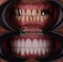 YALIN DENTAL CLINIC / Yalın Ağız ve Diş Sağlığı Polikliniği