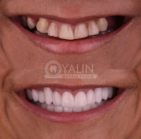 YALIN DENTAL CLINIC / Yalın Ağız ve Diş Sağlığı Polikliniği
