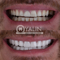 YALIN DENTAL CLINIC / Yalın Ağız ve Diş Sağlığı Polikliniği