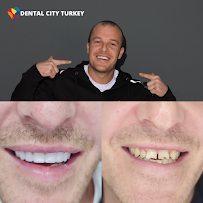 Dental City Turkey