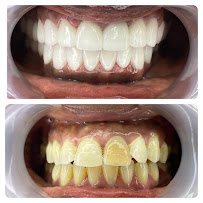 Dental City Turkey