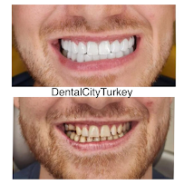 Dental City Turkey