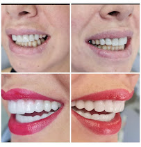 Dental City Turkey