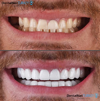Dental Net TURKEY