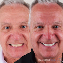 Dental Net TURKEY