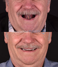 Dental Net TURKEY