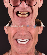 Dental Net TURKEY