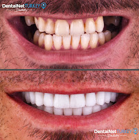 Dental Net TURKEY
