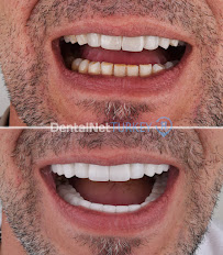Dental Net TURKEY
