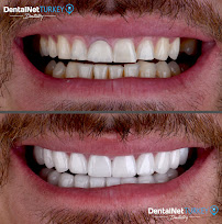 Dental Net TURKEY