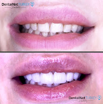 Dental Net TURKEY