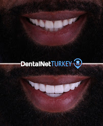 Dental Net TURKEY