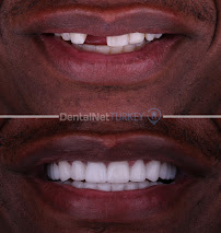 Dental Net TURKEY
