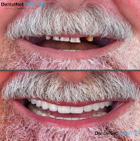 Dental Net TURKEY