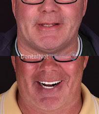 Dental Net TURKEY