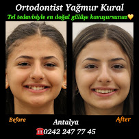 Ortodontist Yağmur Kural