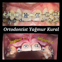 Ortodontist Yağmur Kural