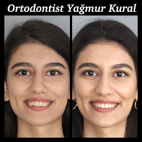 Ortodontist Yağmur Kural