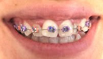 Ortodontist Yağmur Kural