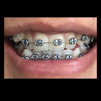 Ortodontist Yağmur Kural