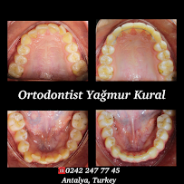 Ortodontist Yağmur Kural