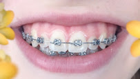 Ortodontist Yağmur Kural