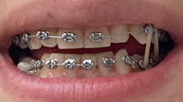 Antalya Smile Designs