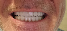 Antalya Smile Designs
