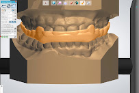Antalya Ortodonti Uzmanı - Uzman Dr. Dt. Pınar Şahin Veske Antalya Diş Teli, Antalya Invisalign Şeffaf Plak Tedavisi