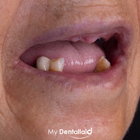 Dental Clinic in İstanbul - Aesthetic Teeth - Teeth Whitening and Veneer - Smile Design - Inlay Onlay