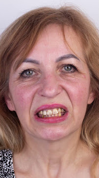 Dental Clinic in İstanbul - Aesthetic Teeth - Teeth Whitening and Veneer - Smile Design - Inlay Onlay