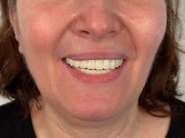 Dental Clinic in İstanbul - Aesthetic Teeth - Teeth Whitening and Veneer - Smile Design - Inlay Onlay