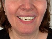 Dental Clinic in İstanbul - Aesthetic Teeth - Teeth Whitening and Veneer - Smile Design - Inlay Onlay