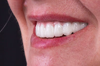 Dental Clinic in İstanbul - Aesthetic Teeth - Teeth Whitening and Veneer - Smile Design - Inlay Onlay