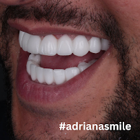 Adriana Smile Antalya