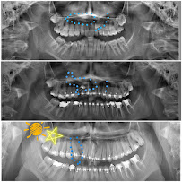 Özel Maredent Ağız ve Diş Sağlığı Polikliniği MAREDENT DENTAL CLINIC