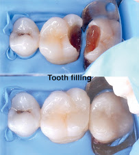 Rejuvie Dental Center Bali - Sanur Branch
