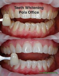 Rejuvie Dental Center Bali - Sanur Branch