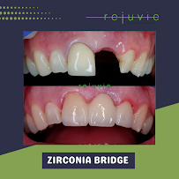 Rejuvie Dental Center Bali - Sanur Branch