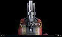 DentaFLY Dental Implant & Smile Studio