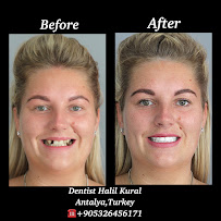 Diş Hekimi Halil Kural (Dentist)