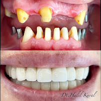 Diş Hekimi Halil Kural (Dentist)